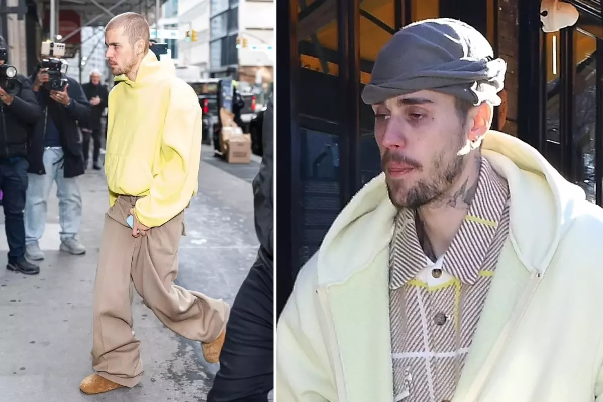 Justin Bieber’ın son hali hayranlarını endişelendirdi