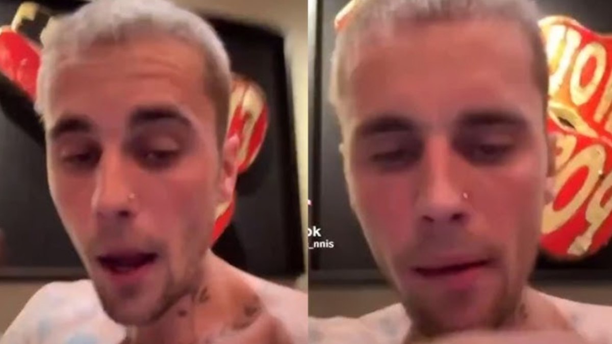 Justin Bieber’ın son hali hayranlarını endişelendirdi! Yorgun ve moralsiz