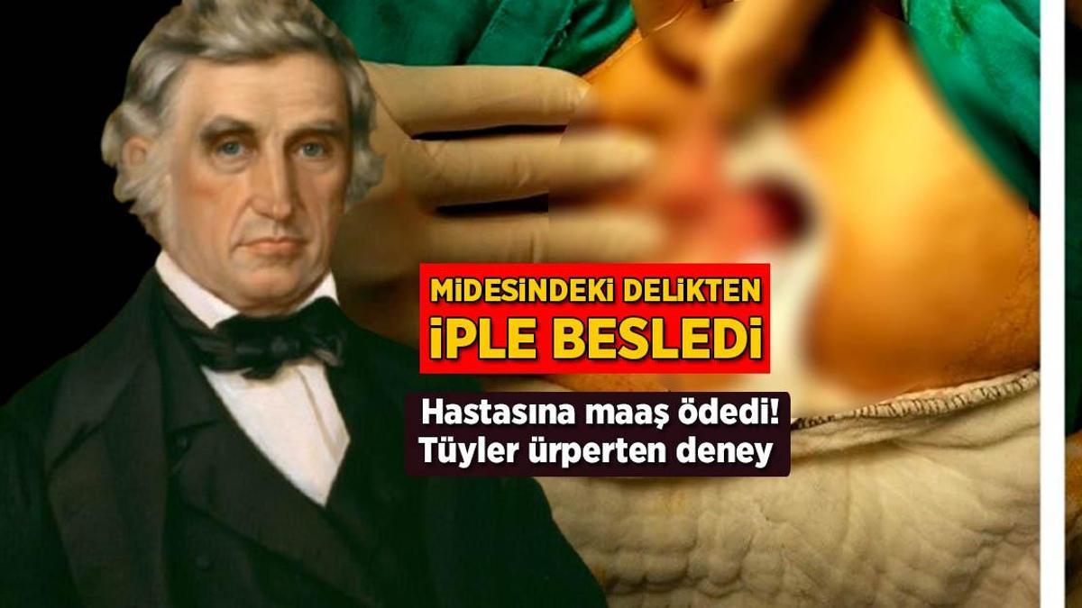 Midesindeki delikten iple besledi! Hastasına maaş ödedi, tüyler ürperten deney